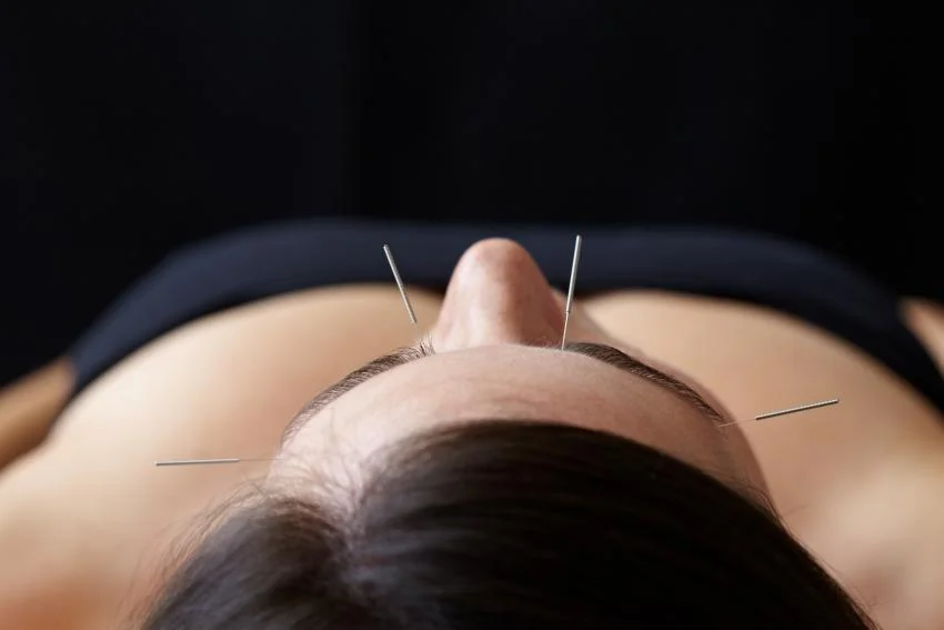 acupunctureb3010-2.jpg