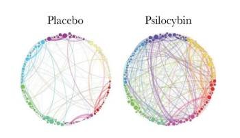 placebo-vs-psilocybin-neuronal-colors-v2.jpeg