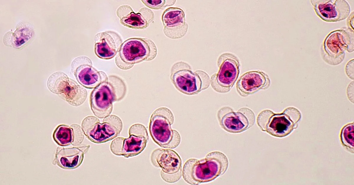 Pine tree pollen, enhanced under a microscope.