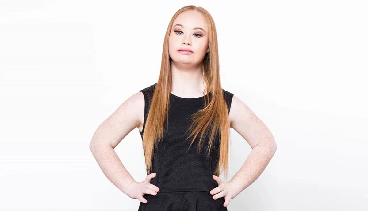 Madeline Stuart, la modelo con Síndrome de Down que está en boca de todos