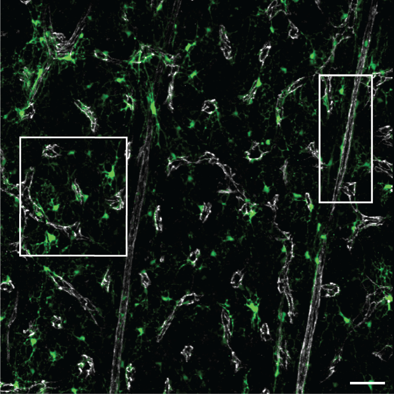 IL7 endothelial screenshot.jpg