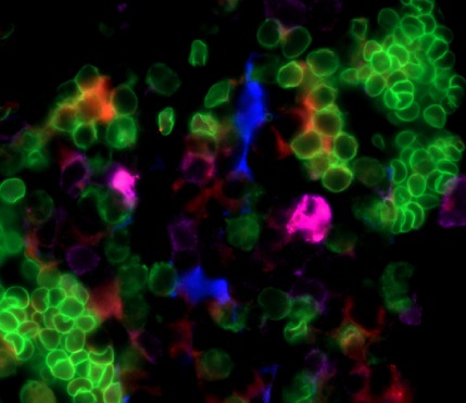 CLPs and IL7 cells .jpg