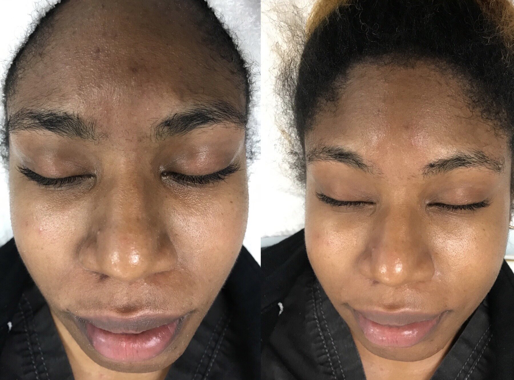 brightening deep pore.JPG