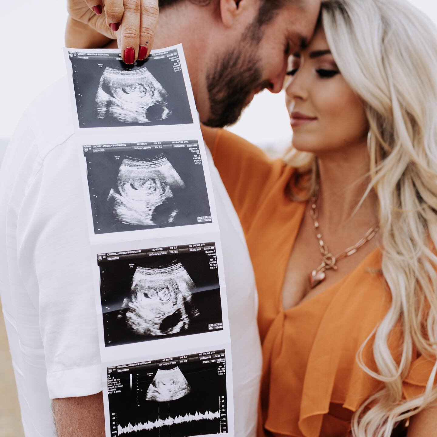 🙌🏻🙌🏻these babes are having a baby!! 🤯 🤗🥰Soo beyond excited for them to become parents!! They are going to be the cutest mom and dad!!