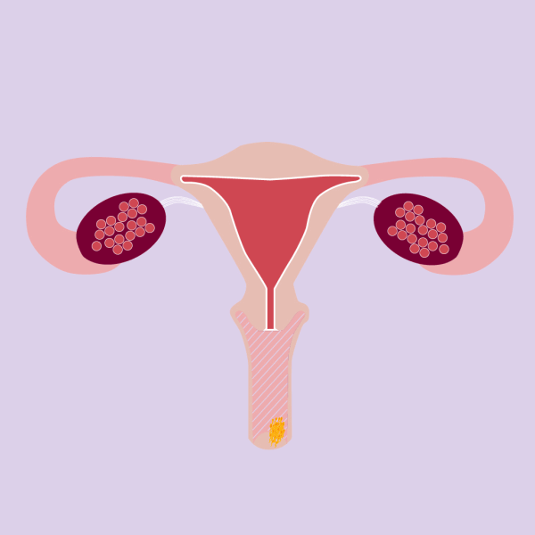 Educational_Treatment_3.gif