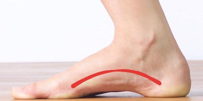 medial arch support for flat feet