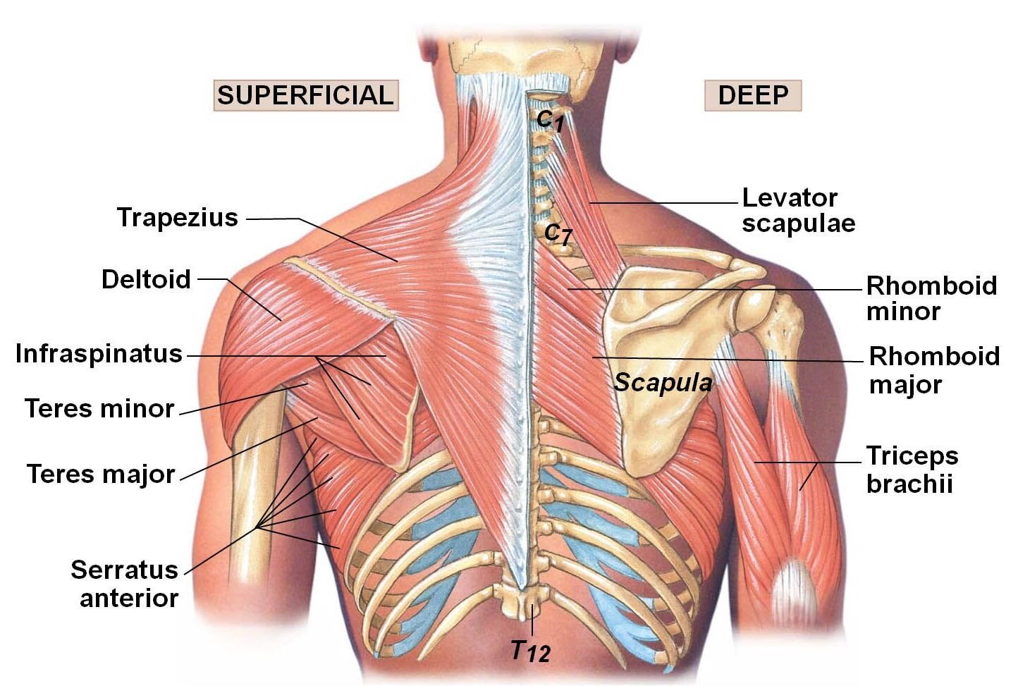 Muscle injury of the upper back