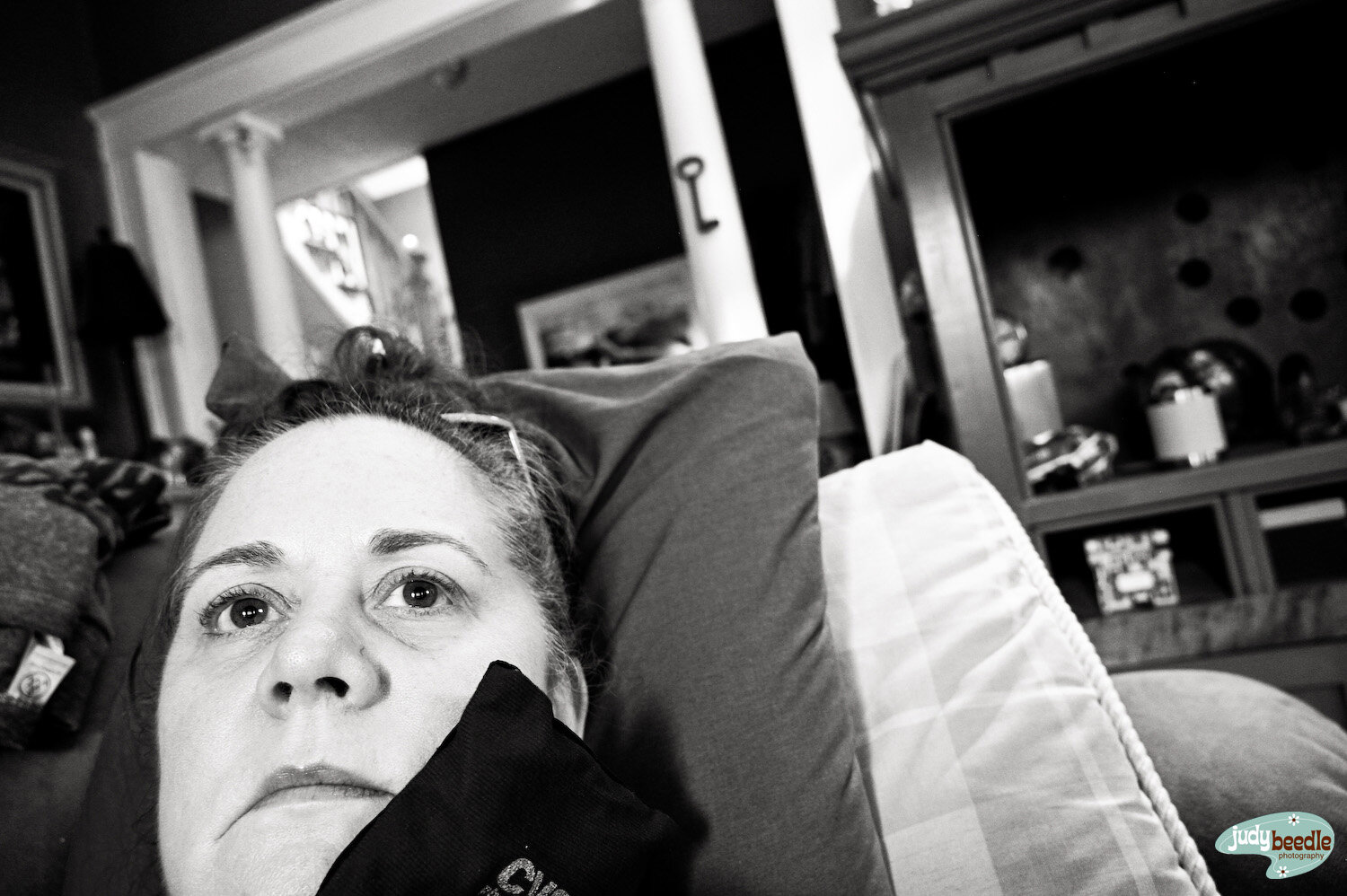 9/26. A fractured tooth no longer lives in my mouth. So here’s a selfie of my laying around with an ice pack on my face.