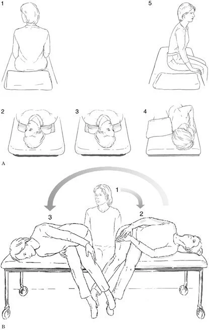 BPPV