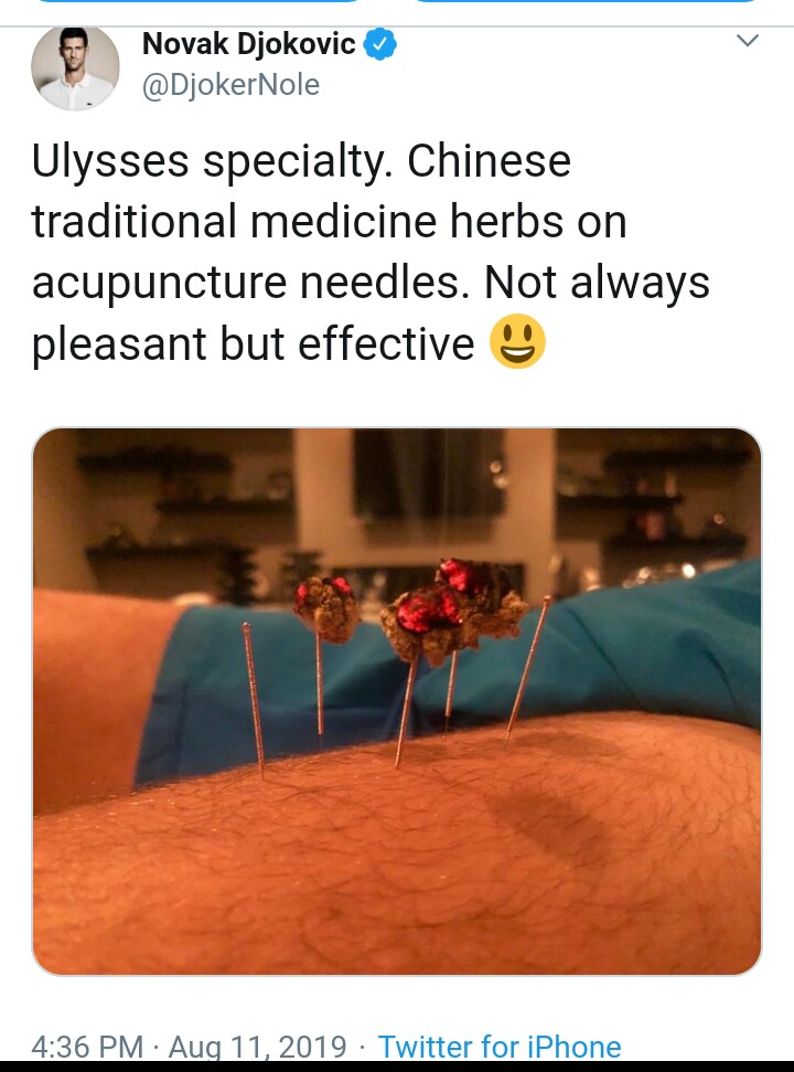 Tennis Star Endorses Acupuncture's Effectiveness
