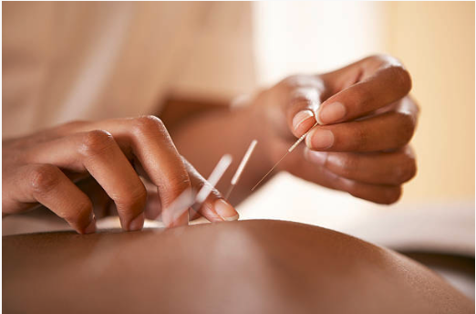 At Nirvana Wellness Centre we perform both Contemporary Acupuncture and Traditional Chinese Medicine (TCM)