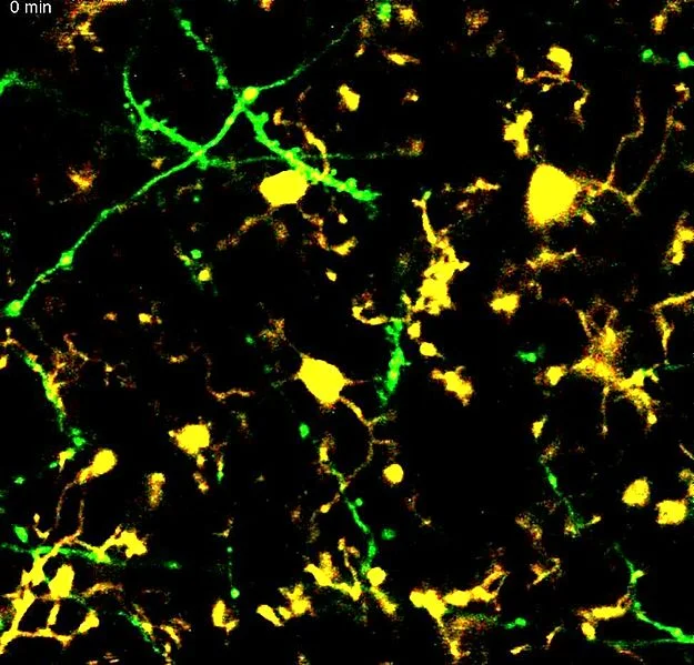 Microglia.jpg