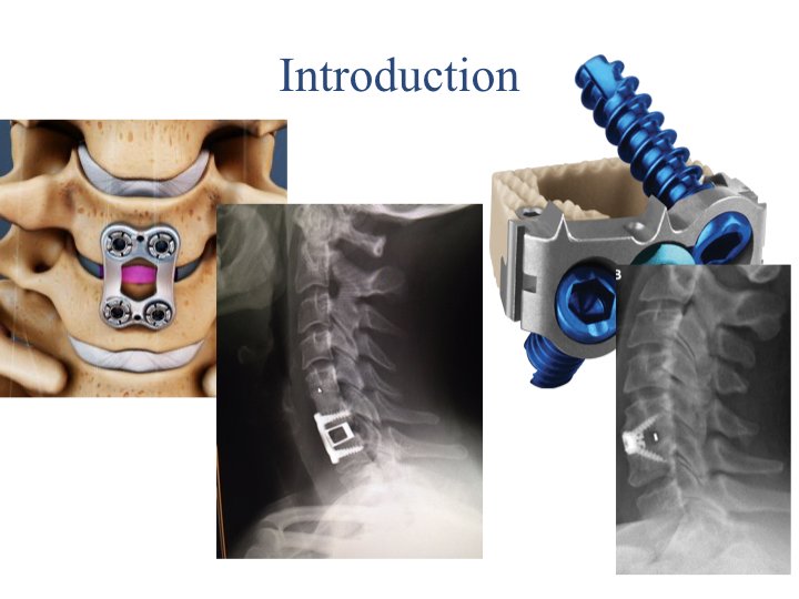 Motion Preserving Spine Surgery.007.jpeg