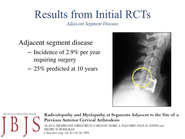 Motion Preserving Spine Surgery.021.jpeg