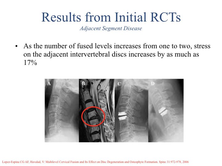 Motion Preserving Spine Surgery.022.jpeg