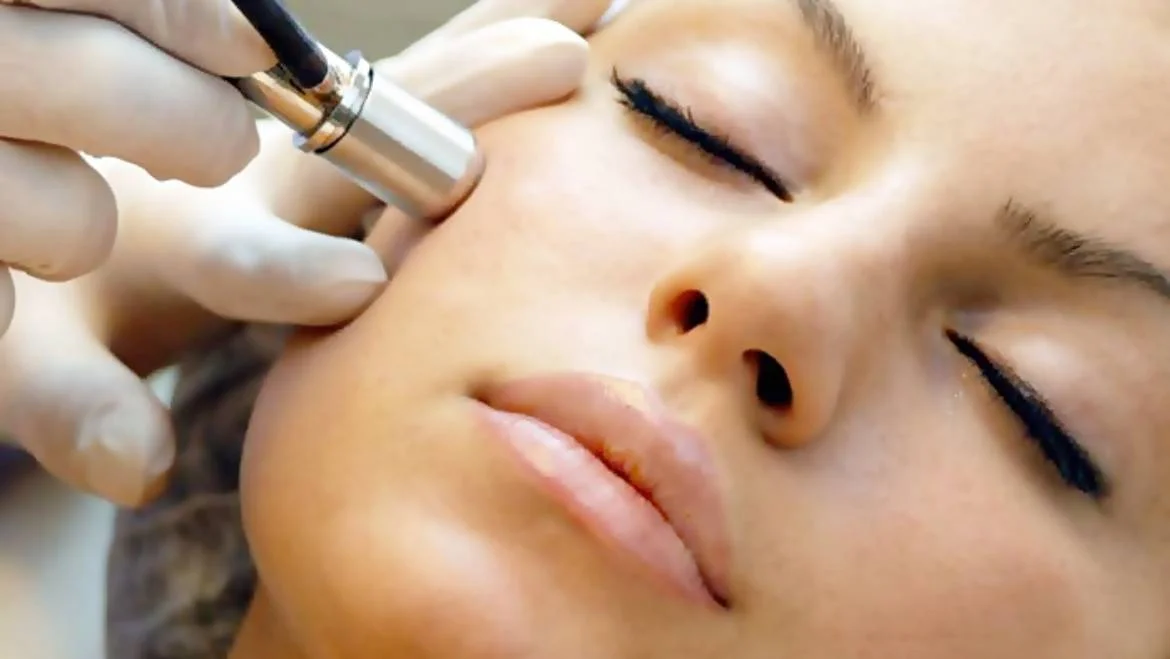 microderm-2-1170x659.jpg