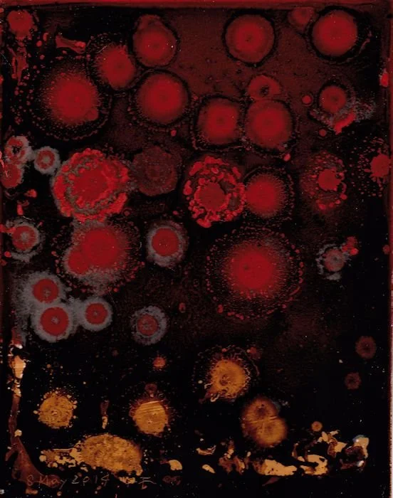 Clot Twist: The Time I Received a Hanukkah Health Miracle - and Almost Died Again Three Days Later