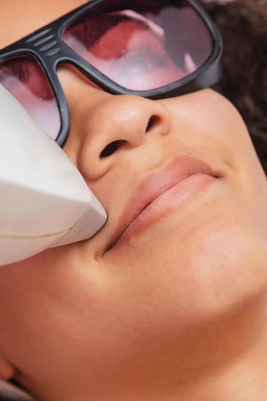 Laser Hair Removal: Small Area (6-pack)