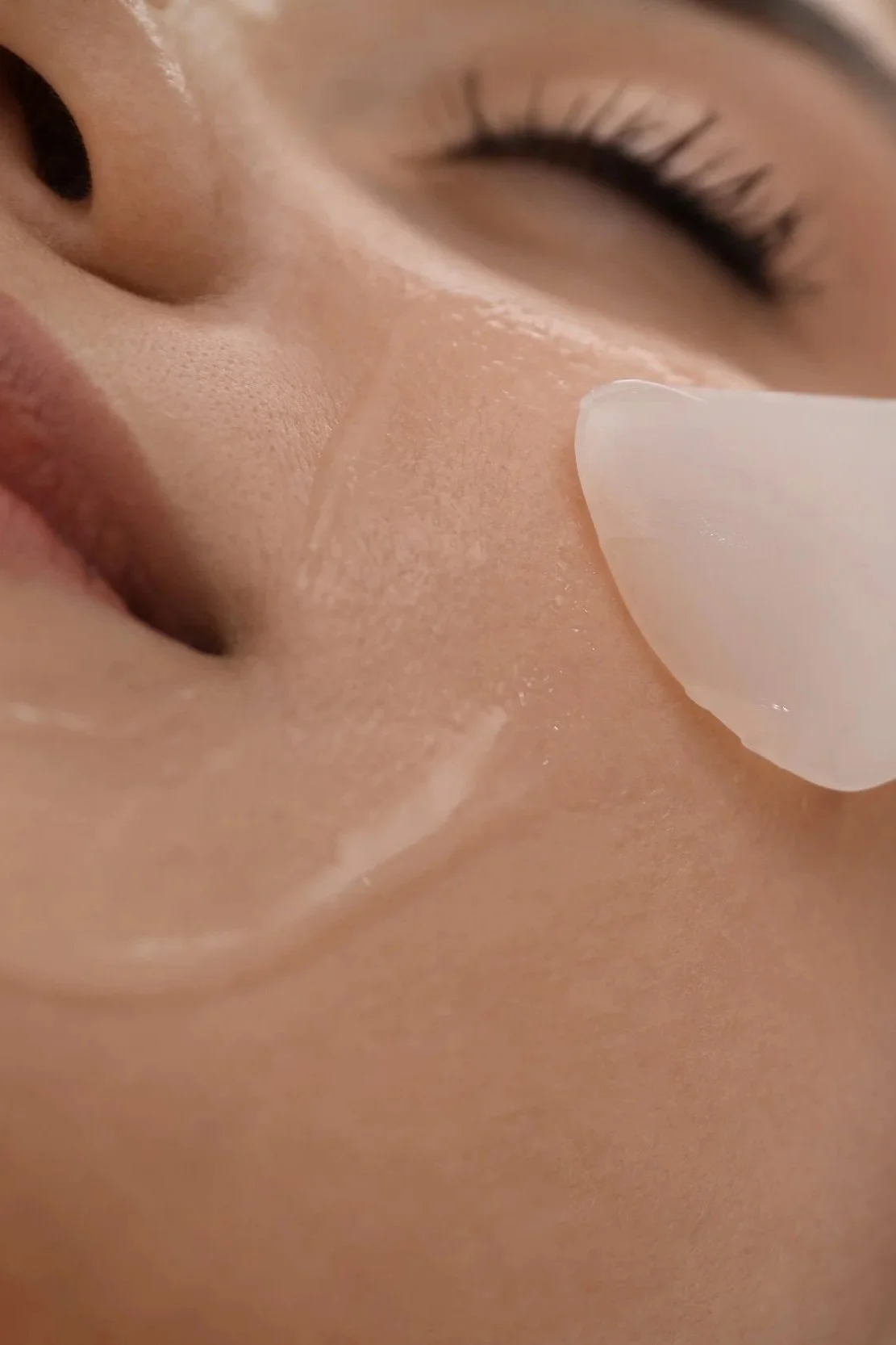 Chemical Peel: Medical-Grade Superficial Peel (3-pack)