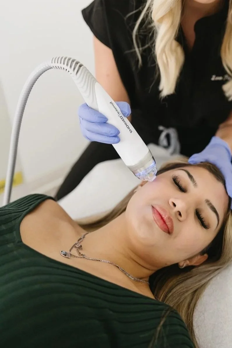 Microneedling with Radiofrequency (3-pack)