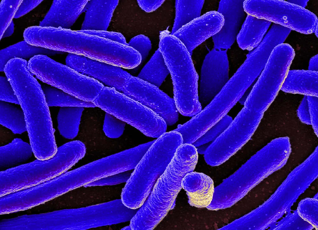 ecoli.jpg