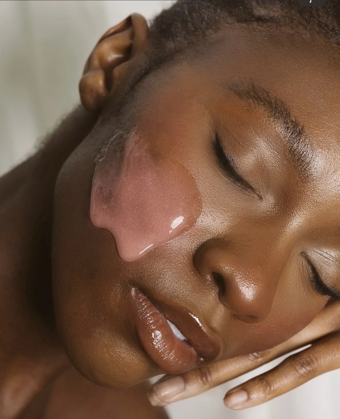 Microneedling Benefits for Calgarians and Our Wild Weather