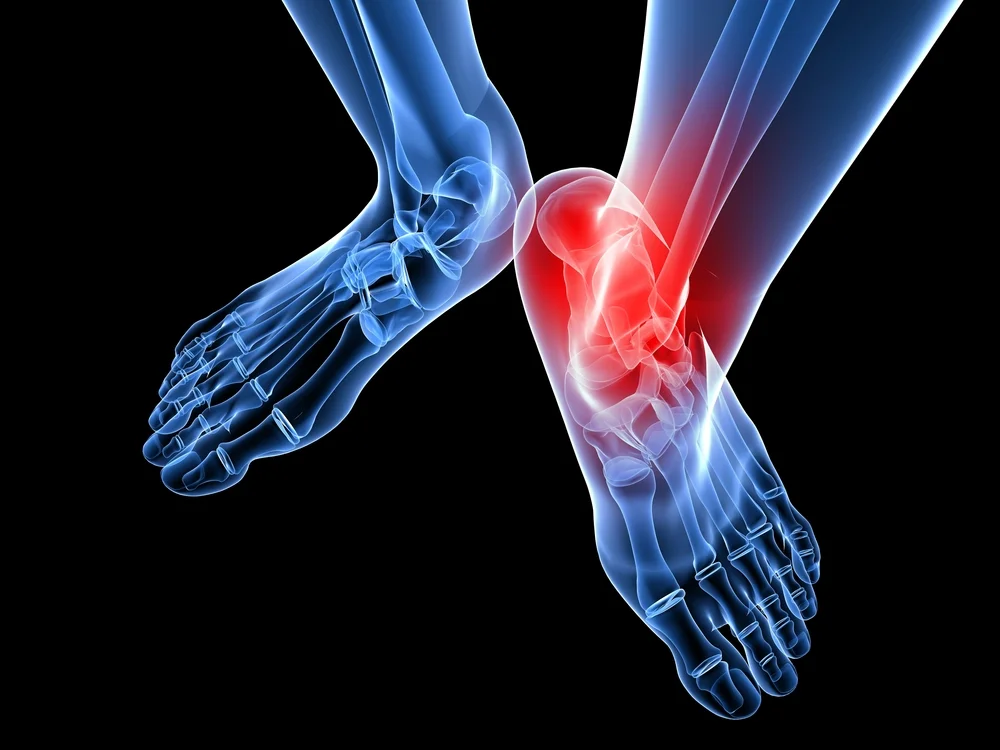 hammertoe treatment & hammetoe correction surgery westhaven ct