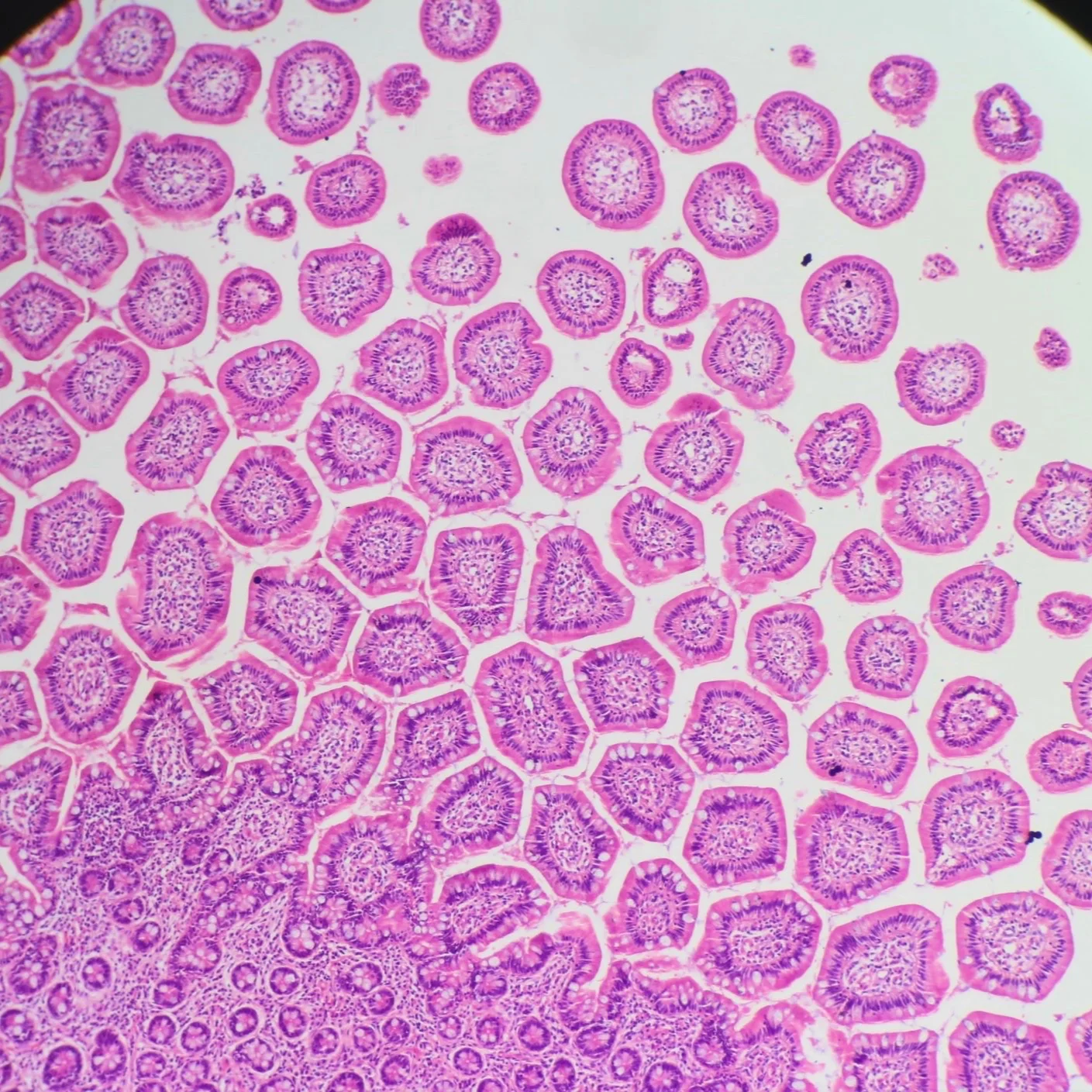 Duodenum: Normal