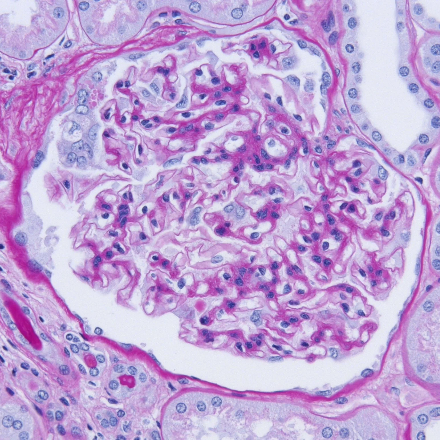 Kidney/PAS: auto-immune