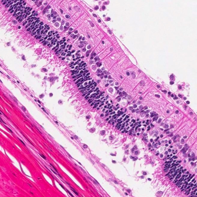 Retina: Experimental