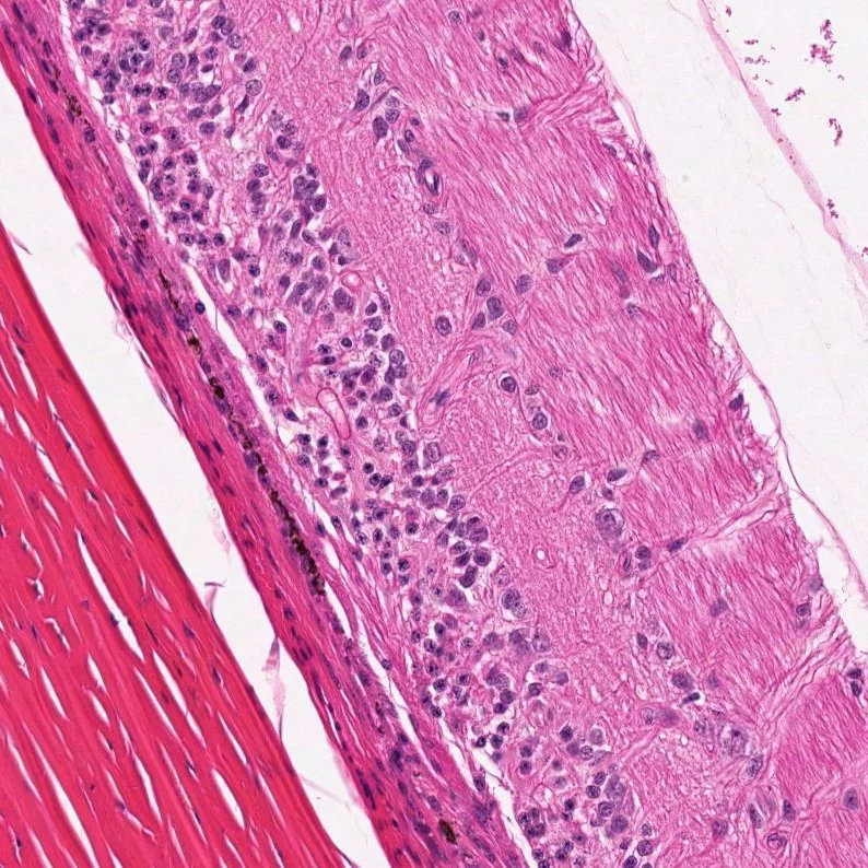 Retina: Experimental