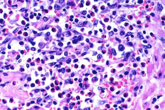 Spleen: white pulp, granulomatous