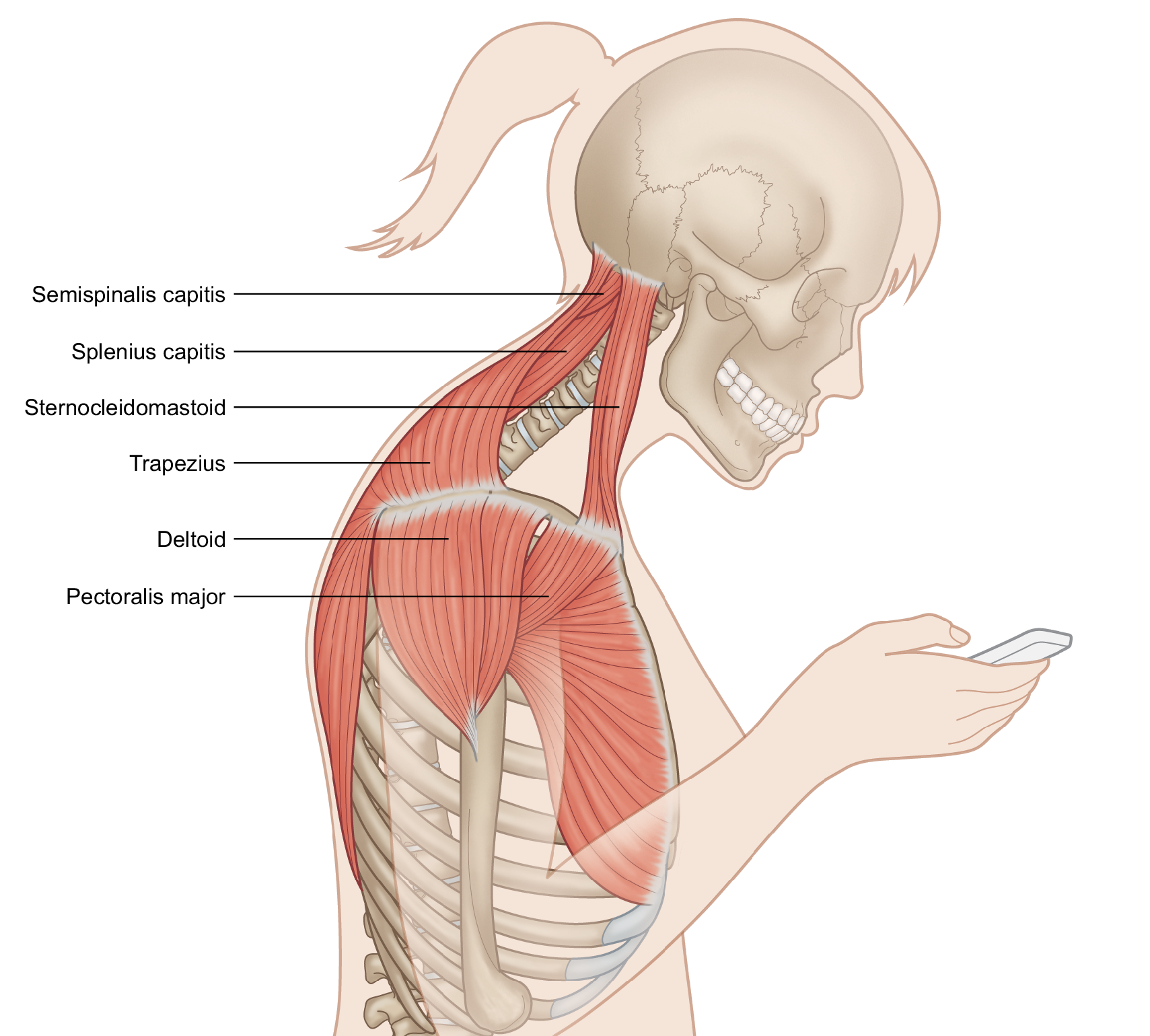 Forward Head Position And Chronic Pain Stacy Dockins