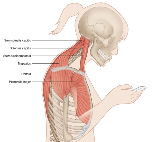 Forward Head Position And Chronic Pain Stacy Dockins