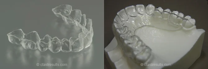 How To Discretely Change Your Smile..