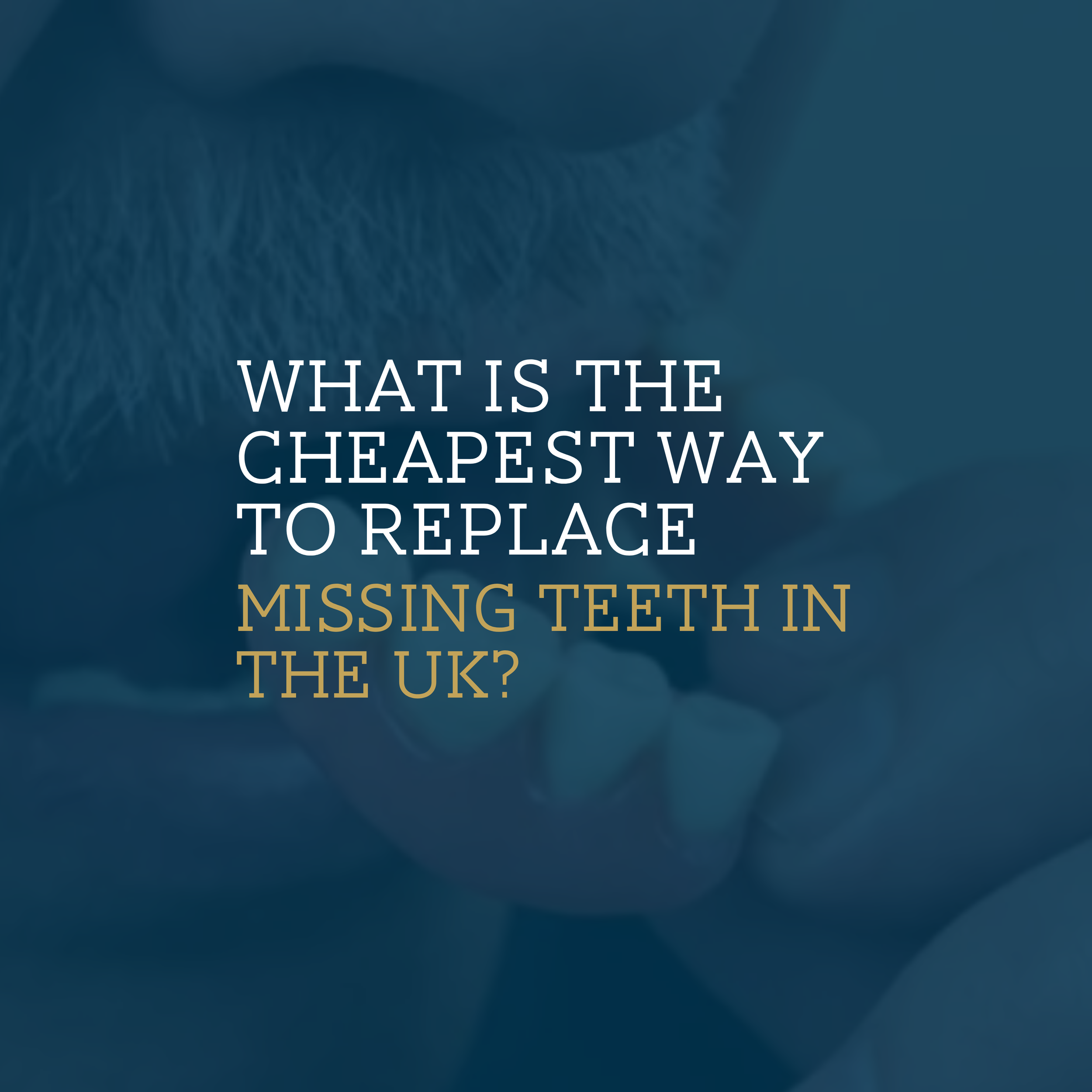 What Is the Cheapest Way to Replace a Missing Tooth in the Uk?