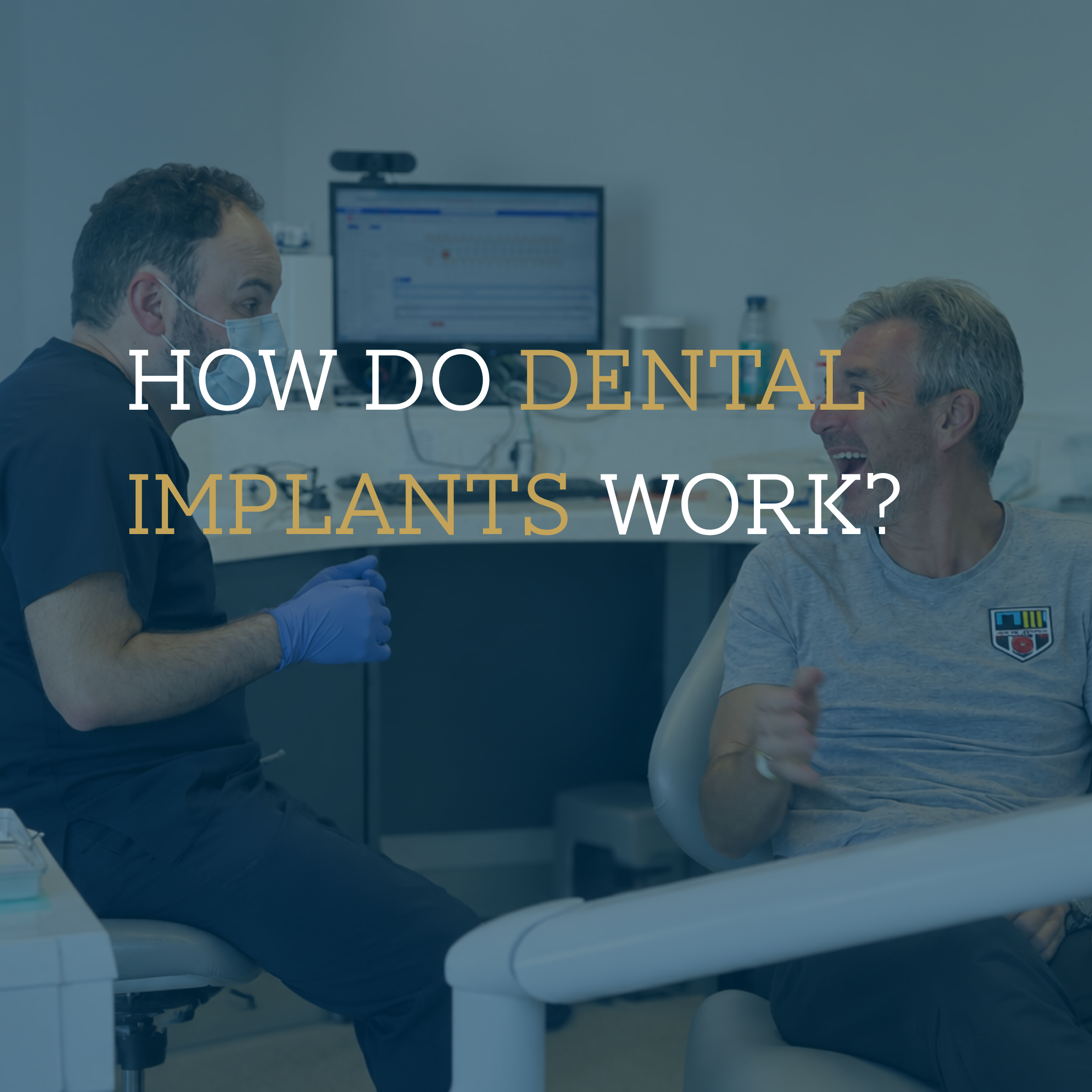 How Do Dental Implants Work? A Simple Guide to Replacing Missing Teeth