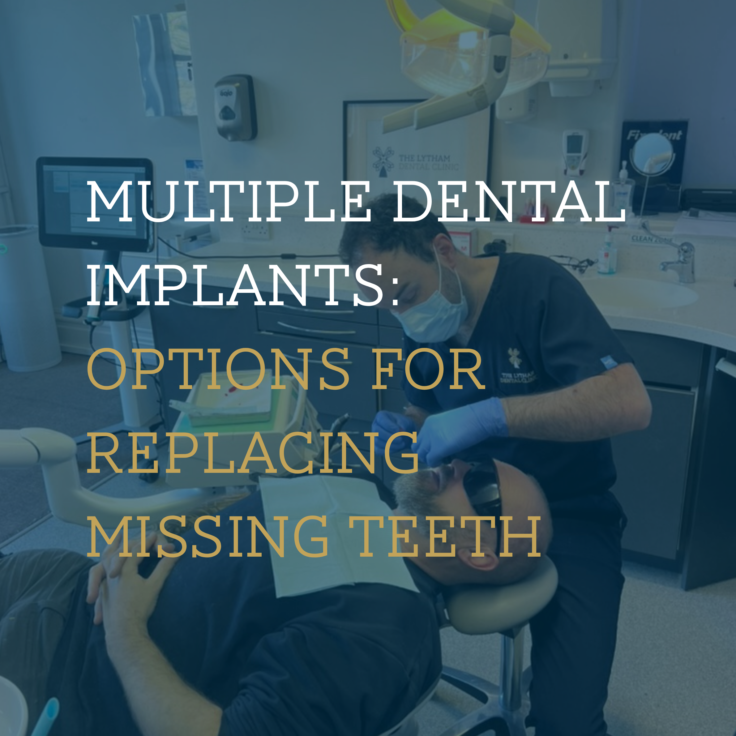 Multiple Dental Implants: Options for Replacing Several Missing Teeth