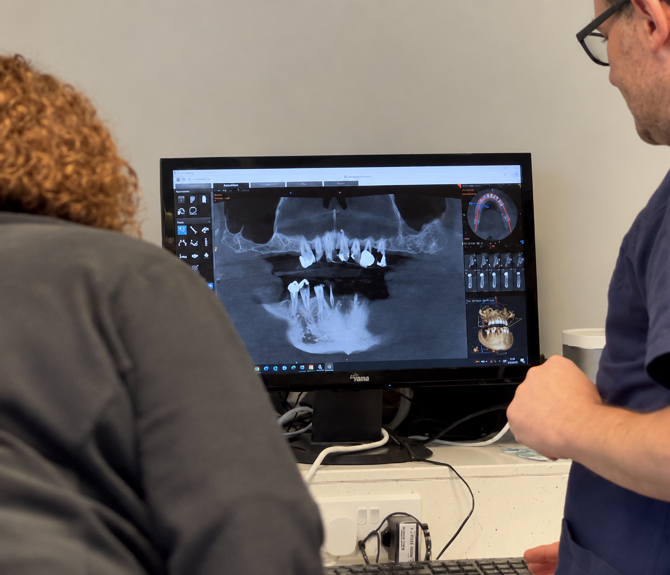 Two people looking at a digital dental X-ray on a computer screen showing teeth and jaw structure during an appointment for dental implants at The Lytham Dental Clinic
