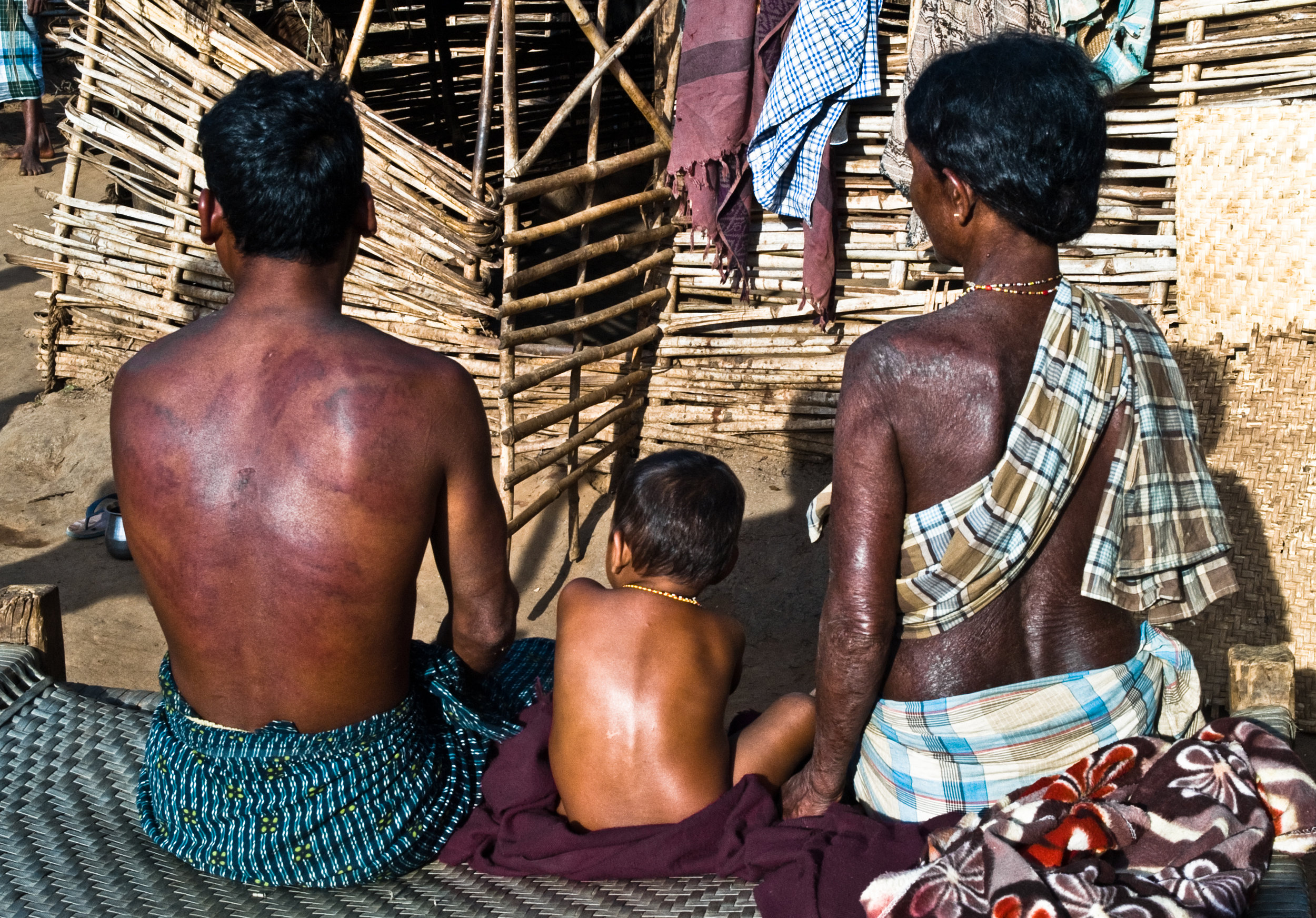 Z10ii Adivasis who were beaten by the police and whose villages were burnt 2.jpg