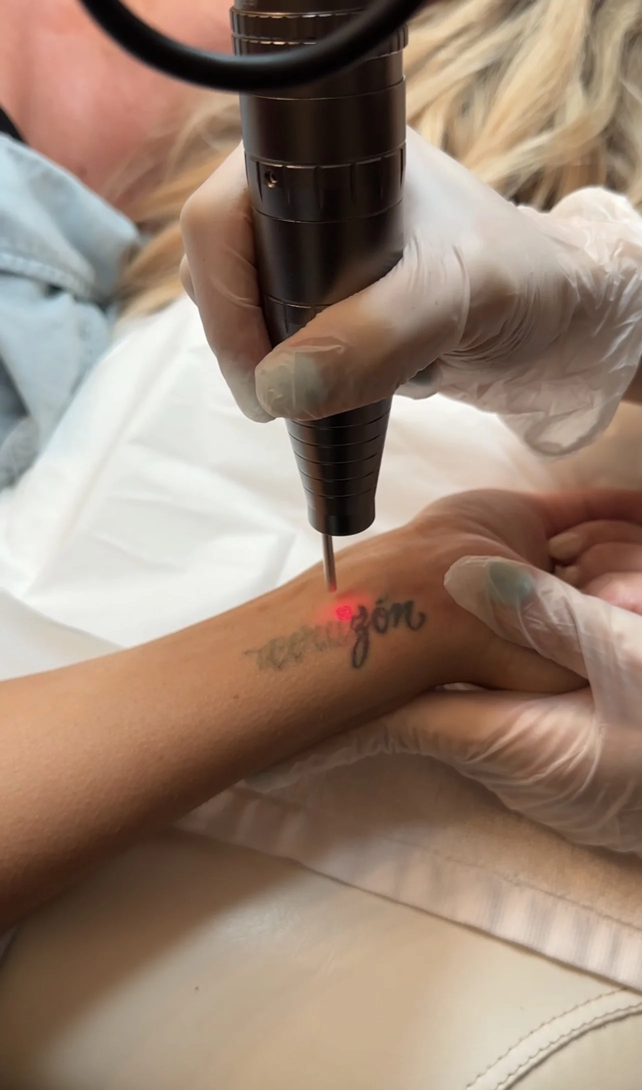 Tattoo Removal Perth — La Belle Peau Skincare Clinic