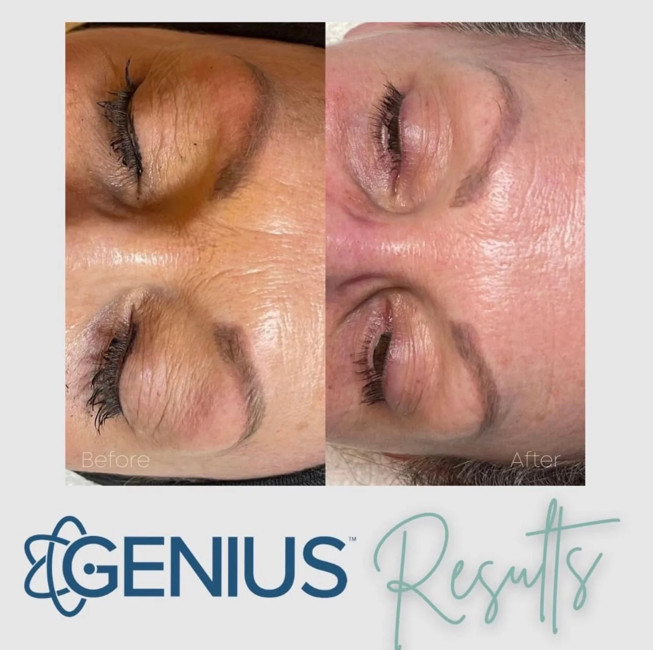 5779B884-06E4-446A-90C1-B6BEF2E3CDE6