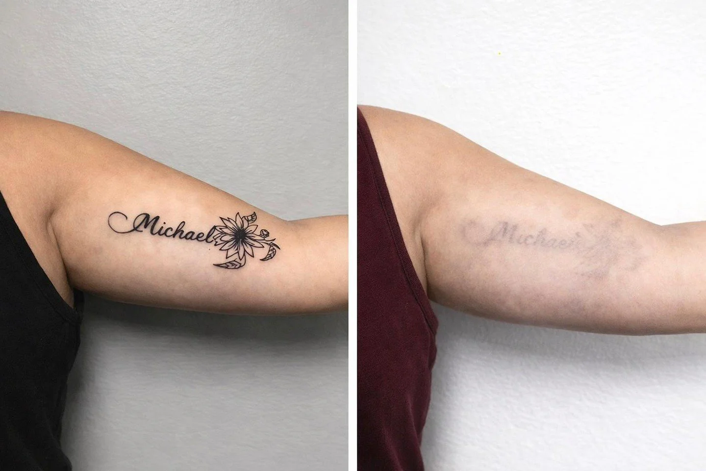 LASER TATTOO REMOVAL ⚡️

Ready to remove a tattoo? Enjoy free consultation and 50% off your first session. 

At La Belle Peau, we prioritize your safety and satisfaction. Our state-of-the-art Lutronic Hollywood Spectra Laser is the world&rsquo;s lead