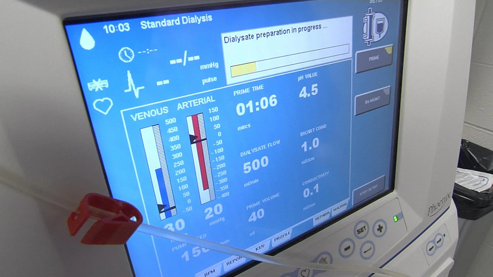 Terapêuticas de substituição da função renal
