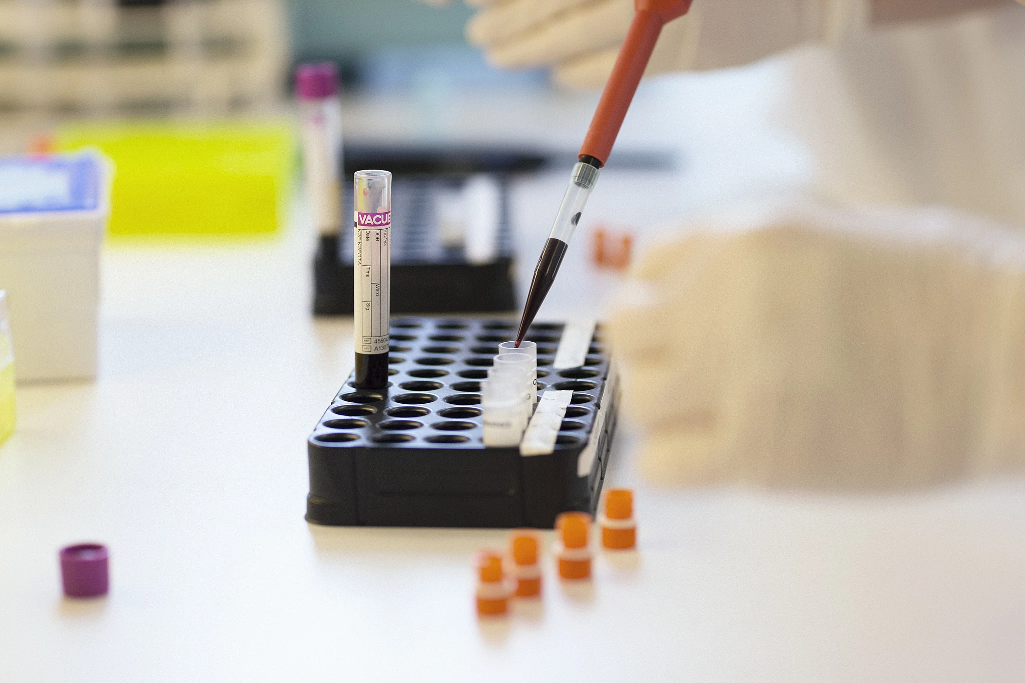 Valores normais de fósforo no sangue