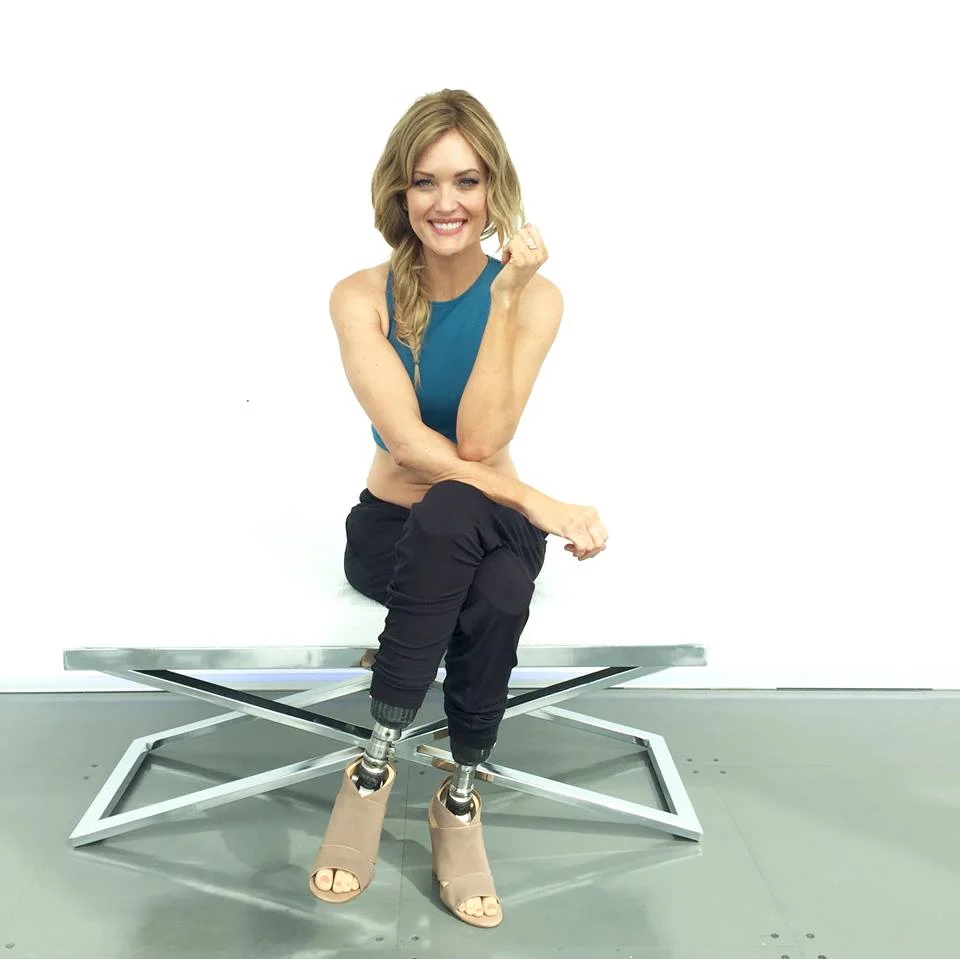 Amy Purdy