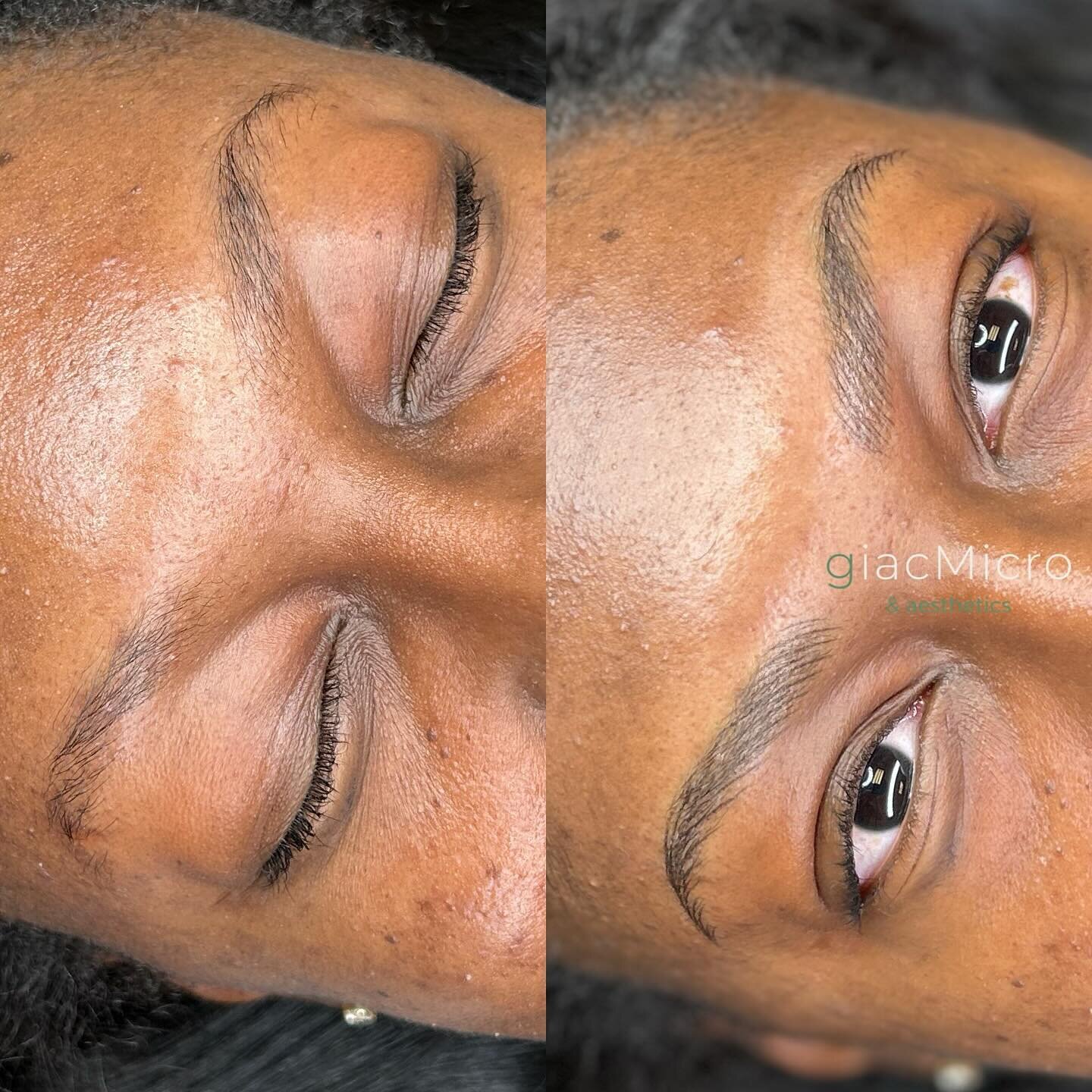Stepping into the new year with perfectly defined Nano Brows🎉

#nano #pmu #browsonfleek #micropigmentation #medicalaesthetic #yeahthatgreenville #downtowngreenville #microblading