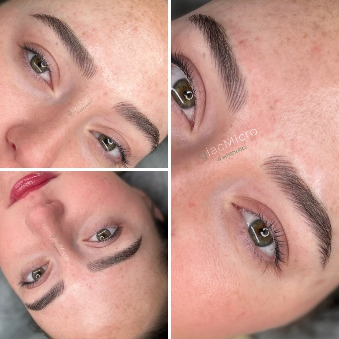 Fully Nano Brows 🤌🏼

What are Nano Brows? 

🤎With Nano, we are using a smaller needle and essentially tapping the pigment into the skin, creating airy-soft hair strokes (instead of making super fine cuts in the skin as with microblading). 
🤎Nano 