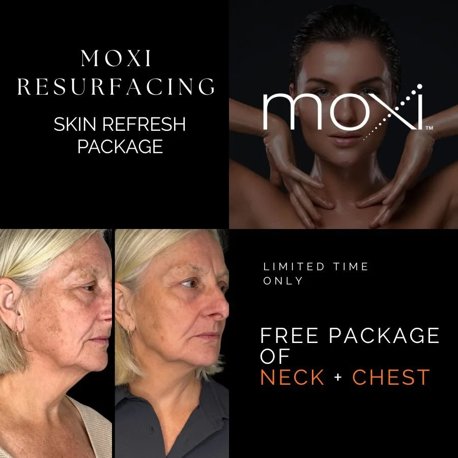 🔥 MOXI RESURFACING PACKAGE🔥