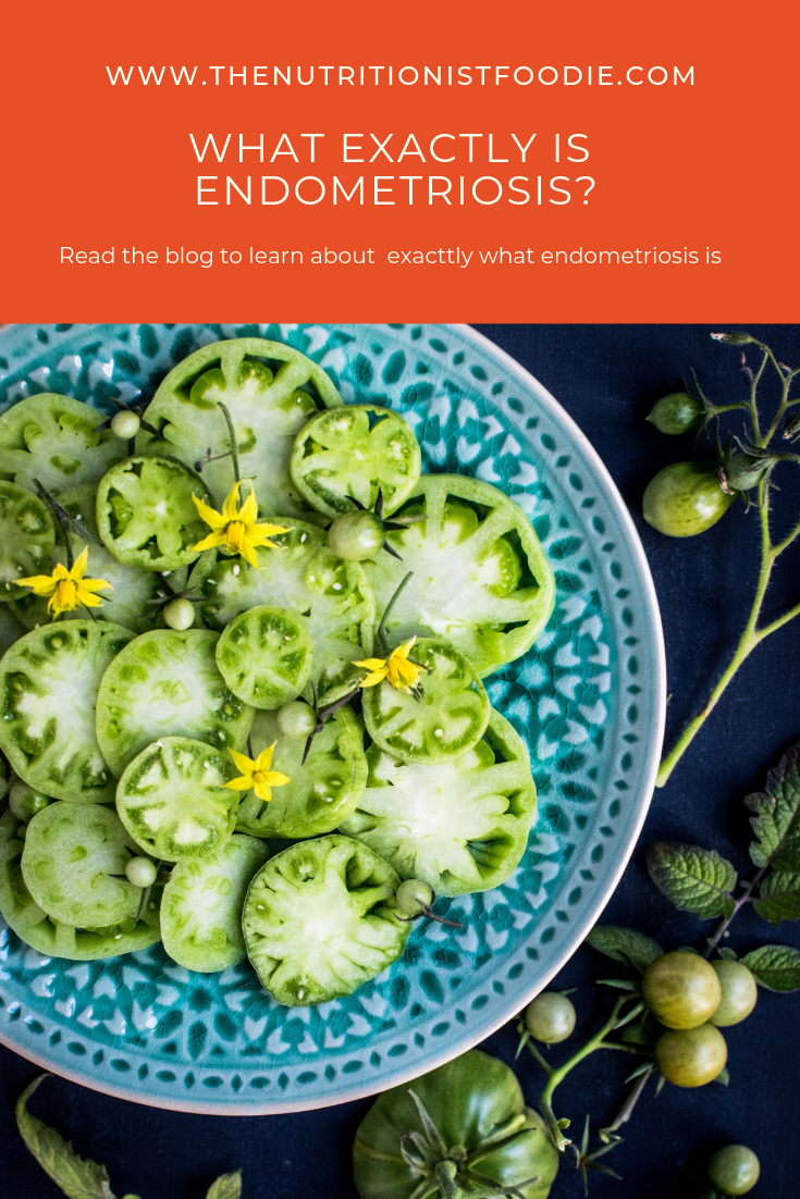 Pinterest post - What is endometriosis?.png